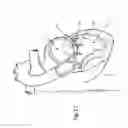 Fig. 17 - Heart valve repair device