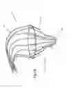 Fig. 23 - Heart valve repair device