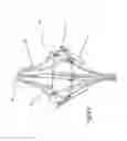 Fig. 24 - Heart valve repair device