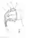 Fig. 26 - Heart valve repair device