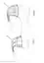 Fig. 27 - Heart valve repair device