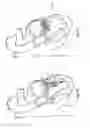 Fig. 30 - Heart valve repair device