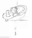 Fig. 35 - Heart valve repair device