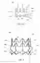 Fig. 05 - Vascular implant