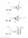 Fig. 16 - Vascular implant