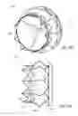 Fig. 45 - Vascular implant