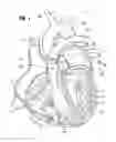 Fig. 02 - Blood flow controlling apparatus