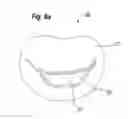 Fig. 17 - Blood flow controlling apparatus