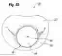 Fig. 18 - Blood flow controlling apparatus