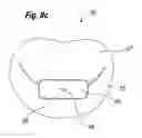 Fig. 19 - Blood flow controlling apparatus