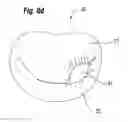 Fig. 20 - Blood flow controlling apparatus