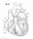 Fig. 24 - Blood flow controlling apparatus