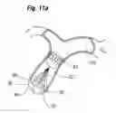 Fig. 28 - Blood flow controlling apparatus