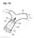 Fig. 30 - Blood flow controlling apparatus