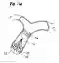 Fig. 31 - Blood flow controlling apparatus