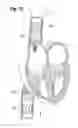 Fig. 32 - Blood flow controlling apparatus