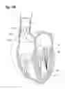 Fig. 34 - Blood flow controlling apparatus