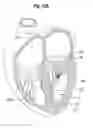 Fig. 40 - Blood flow controlling apparatus