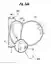Fig. 55 - Blood flow controlling apparatus
