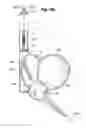 Fig. 56 - Blood flow controlling apparatus