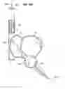 Fig. 57 - Blood flow controlling apparatus