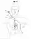 Fig. 58 - Blood flow controlling apparatus