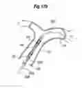 Fig. 59 - Blood flow controlling apparatus