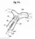 Fig. 60 - Blood flow controlling apparatus