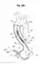 Fig. 63 - Blood flow controlling apparatus
