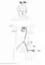 Fig. 66 - Blood flow controlling apparatus