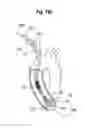 Fig. 68 - Blood flow controlling apparatus