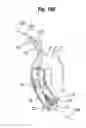 Fig. 69 - Blood flow controlling apparatus