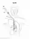 Fig. 70 - Blood flow controlling apparatus