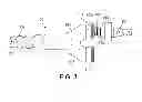 Fig. 04 - Bi-Ventricular Percutaneous Cable