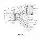 Fig. 07 - Bi-Ventricular Percutaneous Cable
