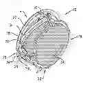 Fig. 01 - ACCOMMODATIVE INTRAOCULAR LENS