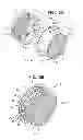 Fig. 03 - ACCOMMODATIVE INTRAOCULAR LENS