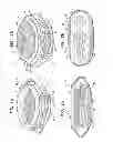 Fig. 02 - Accommodative intraocular lens
