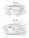 Fig. 04 - Accommodative intraocular lens