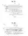 Fig. 05 - Accommodative intraocular lens