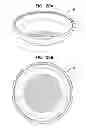 Fig. 20 - Accommodative intraocular lens