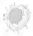 Fig. 22 - Accommodative intraocular lens