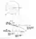 Fig. 01 - Intraocular lens