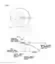 Fig. 02 - Intraocular lens
