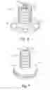 Fig. 05 - Implantable prosthesis for reconstruction of an anatomical feature