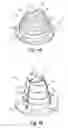 Fig. 07 - Implantable prosthesis for reconstruction of an anatomical feature
