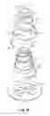 Fig. 08 - Implantable prosthesis for reconstruction of an anatomical feature