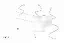 Fig. 09 - Systems and methods for spinal fusion