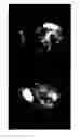 Fig. 01 - Surgical implant and method