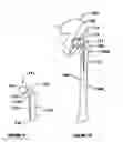 Fig. 04 - Modular, adjustable, prosthetic, hip/shoulder spacer